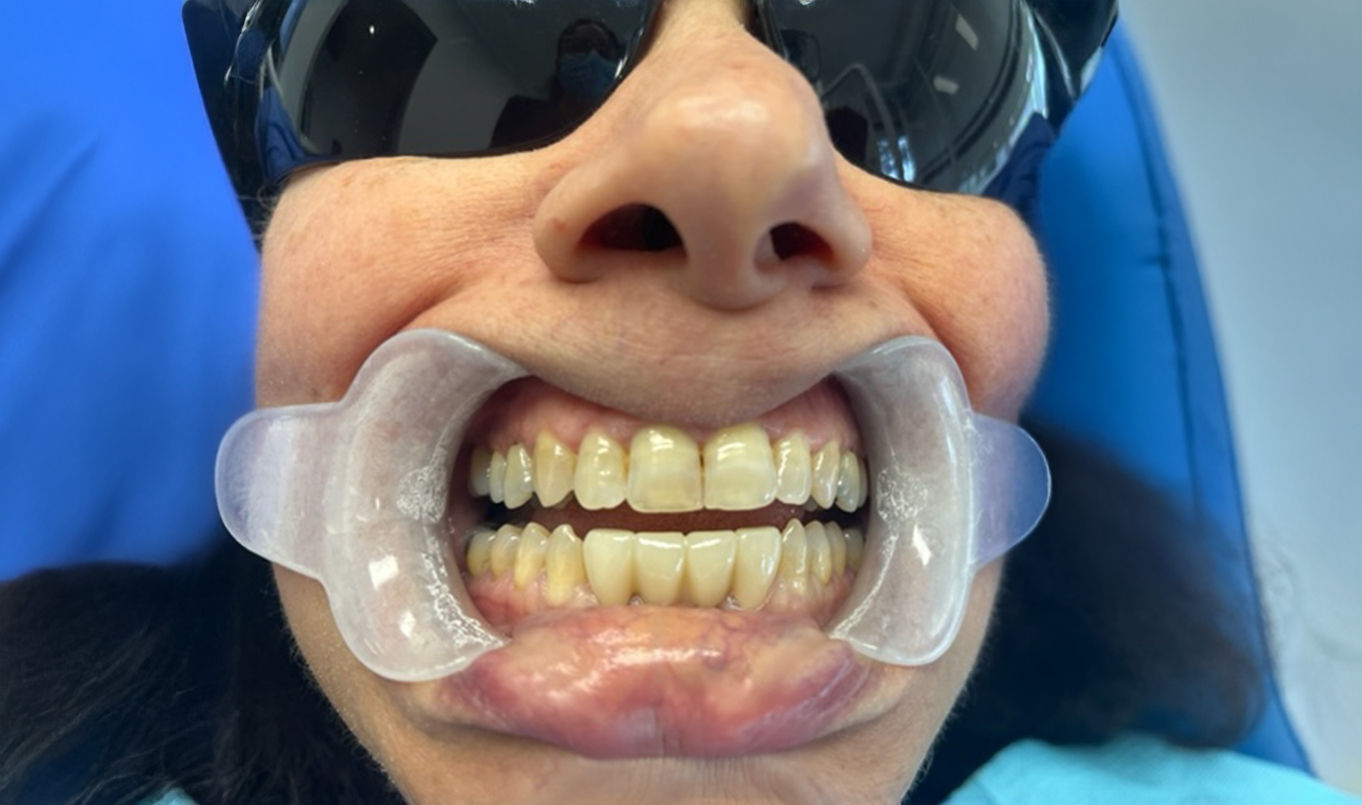 i-Dentistry_img-Resize_2 (3)